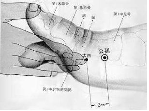 뜸 이미지