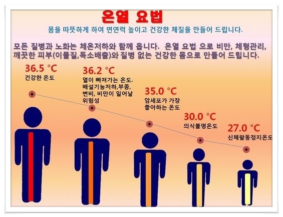 무통약손 이미지