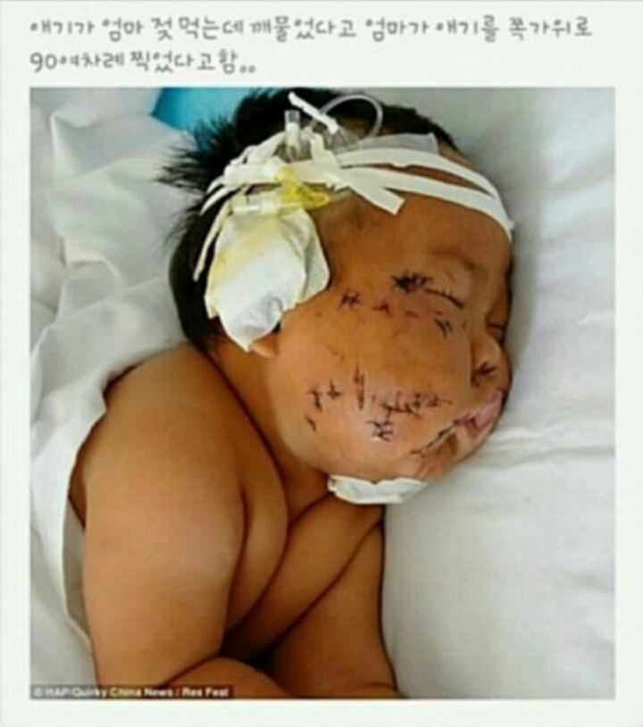 대륙의 미친 애미× | 인스티즈