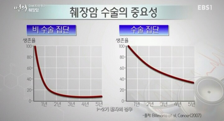 췌장암이 최악의 암으로 불리는 이유.jpg | 인스티즈