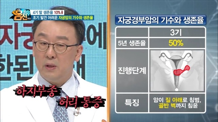 자궁경부암 실제사진.jpg (사진주의) | 인스티즈