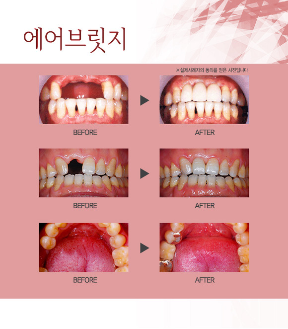 링크브릿지 이미지