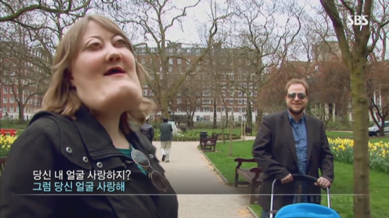 기형적 턱을 가진 여자 비키 라이트가 성형수술을 하지 않는 이유 | 인스티즈