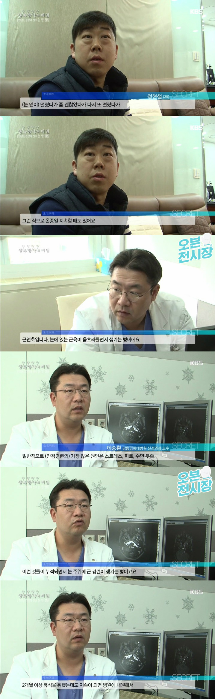 눈 밑 떨림이 2개월 이상 지속될 경우에 의심해봐야 할 질병.jpg | 인스티즈