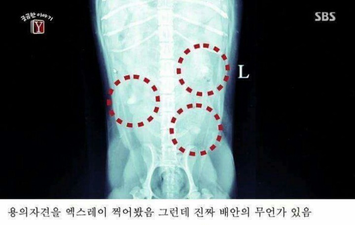 궁금한 이야기 Y 역대급 난제 | 인스티즈