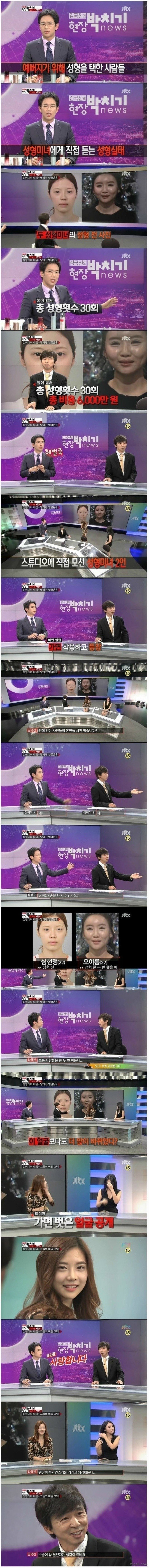 성형만 30번한 여성류 甲 | 인스티즈