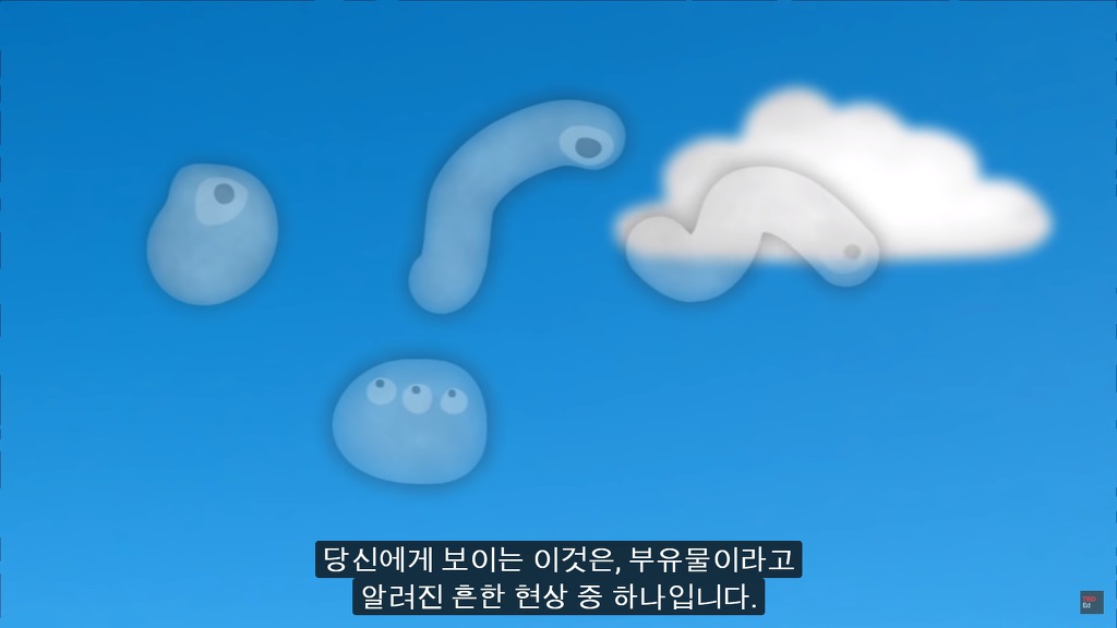 여러분의 눈에 둥둥 떠다니는 그것들은 무엇일까요? | 인스티즈