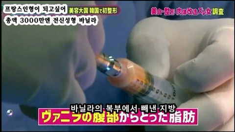 프랑스 인형이 되고싶어 총액 3000만엔 전신성형한 바닐라 | 인스티즈